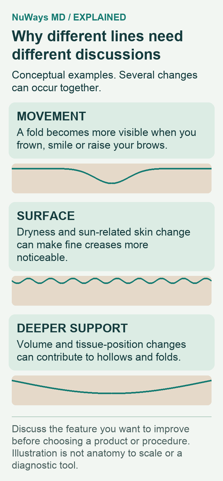 Conceptual profiles illustrate movement folds, fine surface lines and deeper contour changes. Multiple contributors can occur together.