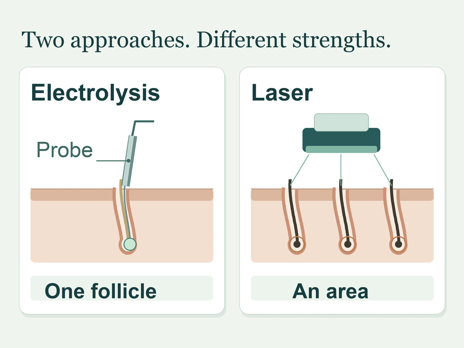 Conceptual comparison: electrolysis applies energy inside one follicle, while laser uses light to target pigmented hairs across an area